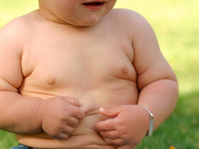la obesidad en los niños de la foto