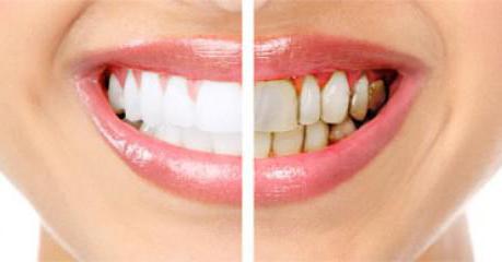 disease of the teeth and gums