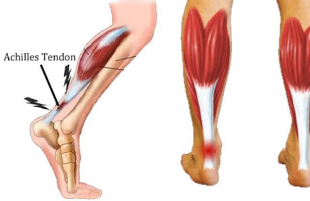 los tendones de la pierna