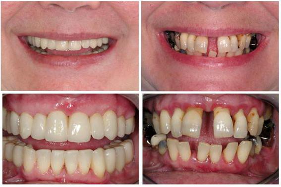 as mais terríveis dentes de uma pessoa