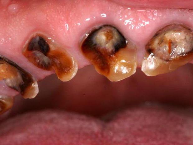 schreckliche Zähne