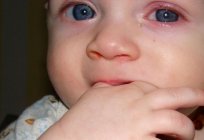 إذا اكتشفت التهاب الملتحمة في الأطفال من علاج المرض