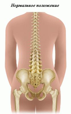 laterais curvatura da coluna vertebral são chamados de
