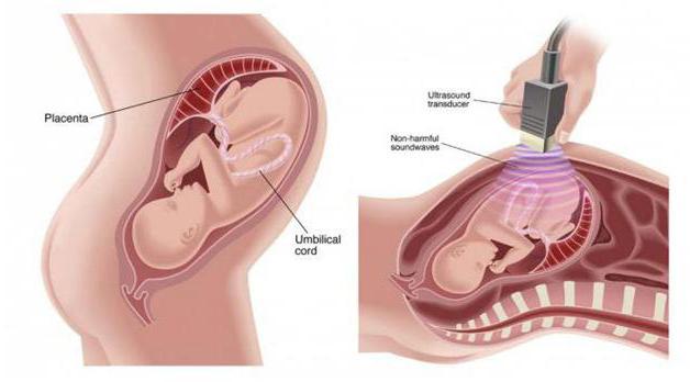 4D ultra-som durante a gravidez