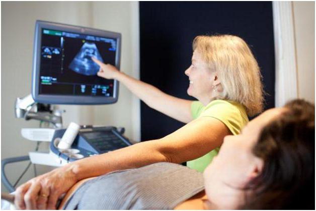 4D ultrasound photo
