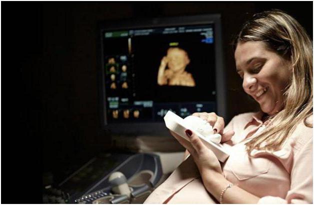 4D fetal ultrasound