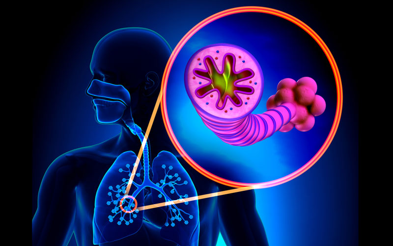 Emphysema. The reasons