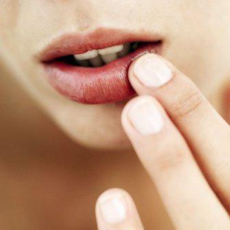 die Behandlung von Rissen in den Ecken der Lippen
