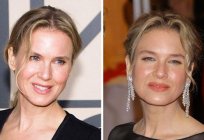 Renee Zellweger before and after plastic surgery: comparison