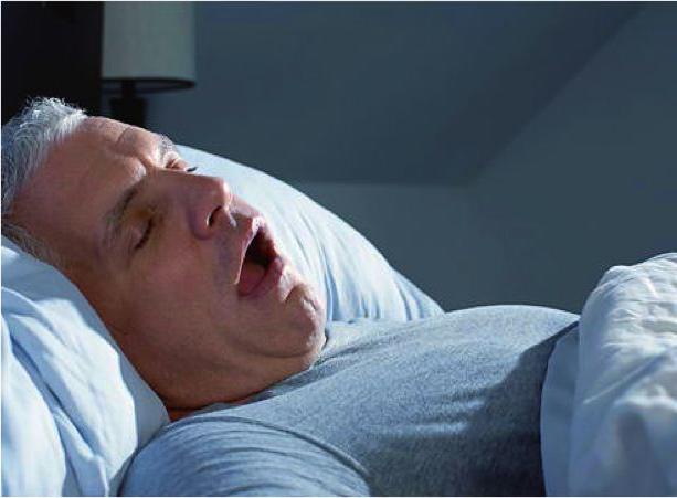 متلازمة أوندين لعنة متلازمة توقف التنفس أثناء النوم