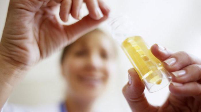 urine test cystitis