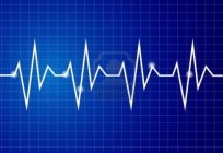 Deşifre cardiogram – en güvenilir tanı yöntemi