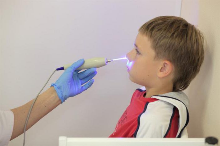 treatment of adenoids in children laser reviews