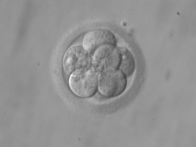 种植的胚胎在外
