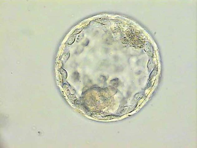 种植的胚胎在环境中的embriogen