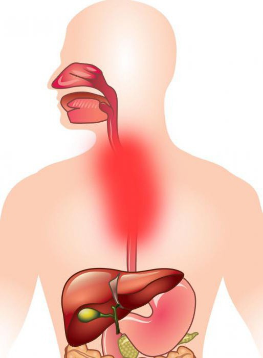 la úlcera de esófago, síntomas y tratamiento