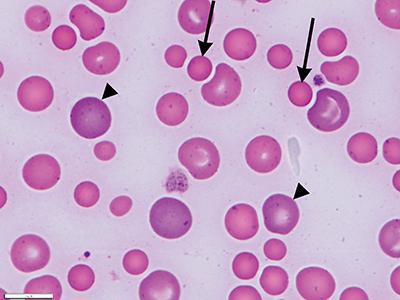 baixo анизоцитоз de glóbulos vermelhos no sangue