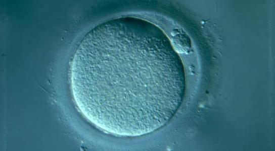 características da espermatogênese
