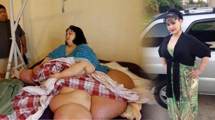 дуже товсті люди які схудли фото до і після