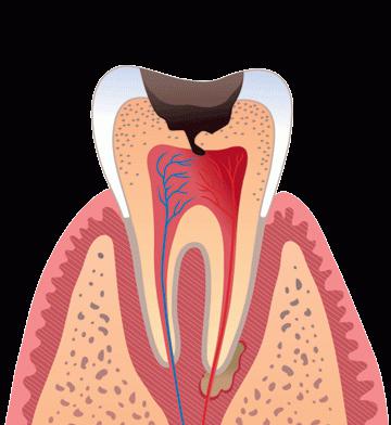 Erkrankungen der Zähne und der Mundhöhle