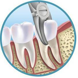 Zahnschmerzen Behandlung