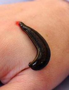 where to put leeches for weight loss