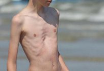 Anorexic - who is this? Dystrophy