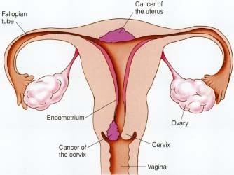 endocervix treatment