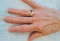 Опух o dedo na mão: causas e tratamentos
