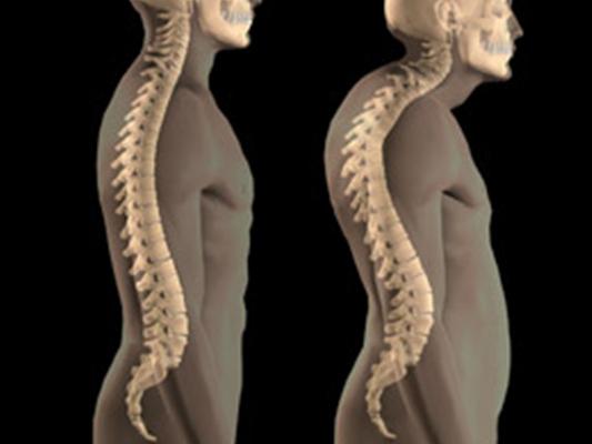what is osteoporosis