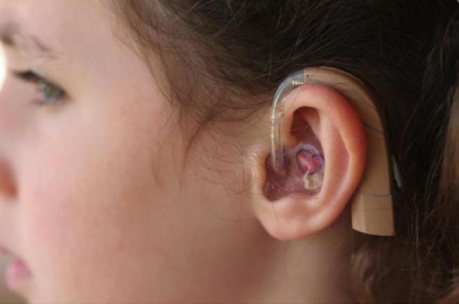 die Wiederherstellung der Hörfähigkeit bei Kindern