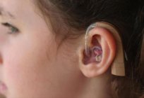 聴覚修復にsensorineural聴覚障害の後、耳の感染症、手術後の子どもの
