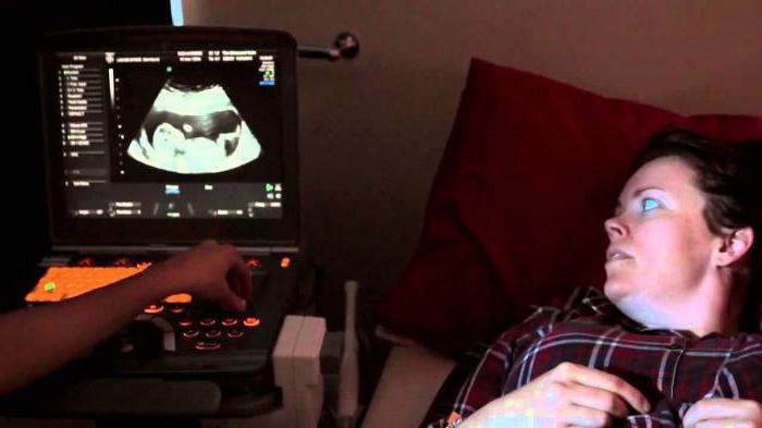 tarama 1 trimester normal ultrason fotoğraf