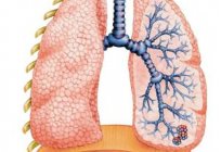 慢性阻塞性肺部疾病威胁的生命的烟草使用者