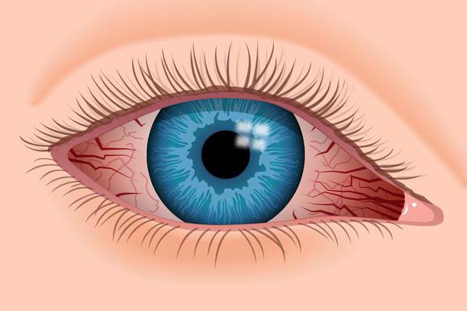 आंख बूँदें vasoconstrictor