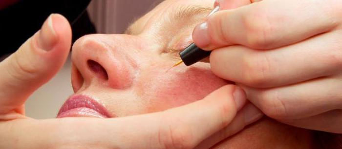 remove blood vessels on the face with a laser