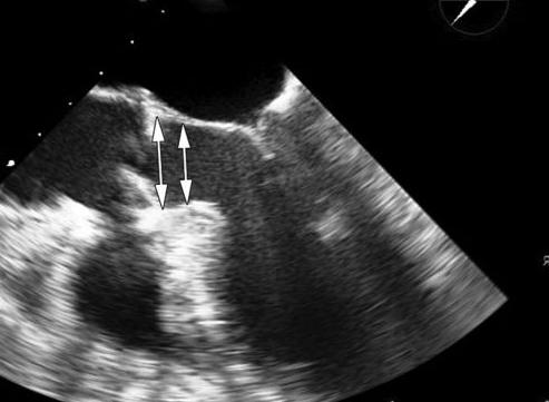transesophageal echocardiography reviews of physicians