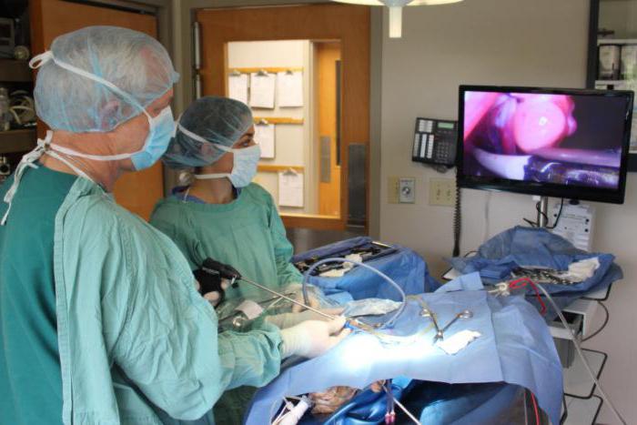 la apendicectomía el curso de la operación