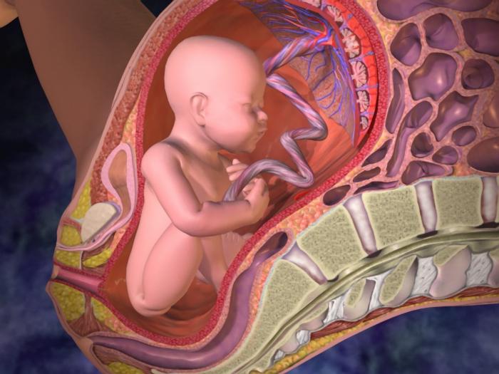 el Desprendimiento de la placenta en el primer trimestre