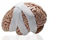 Gehirnerschütterung: was ist zu tun für die Unterstützung der Patient?