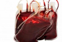 Kan nakli: biyolojik örnek ve uyumluluk tablosu kan grupları