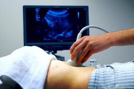 to do an abdominal ultrasound to Ekaterinburg