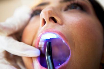 ملامح من تبييض الأسنان في طب الأسنان الحديث