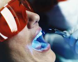 teeth Whitening in dentistry - contraindications