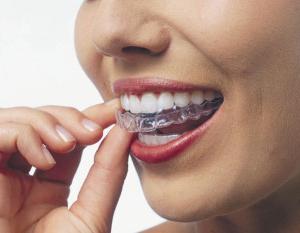 Колькі каштуе адбельванне зубоў у стаматолага і дома