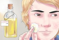Antibiotics for acne on the face: tablets, ointments, creams