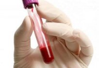 La enfermedad de la anemia - ¿qué es?