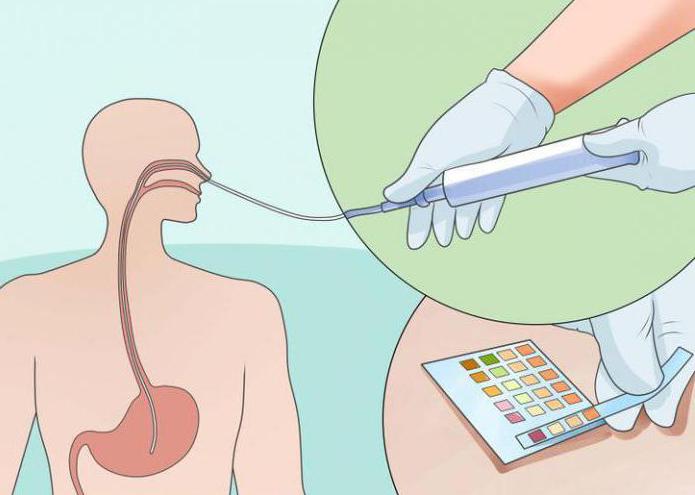 la alimentación del paciente a través de una sonda nasogástrica