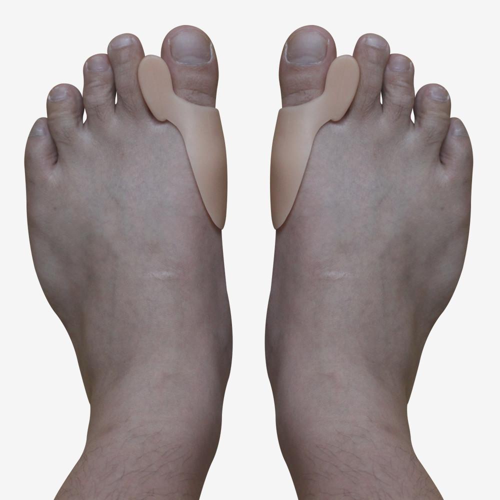 a Artrite do dedo grande do pé