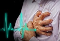 Miyokard enfarktüsü: nedenleri, tanı, belirtileri ve tedavisi